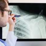 Médico observa una radiografía de una fractura de clavicula