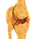 Visión de una rodilla en 3D donde se aprecia el ligamento cruzado anteior